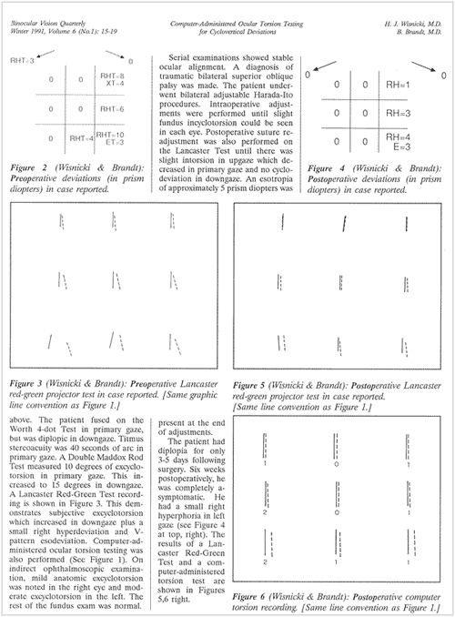 Computer Administered Ocular Torsion Testing for Cyclovertical Deviations